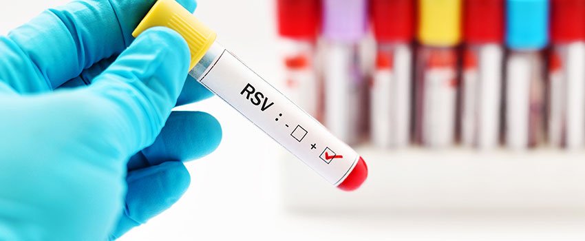 What Are the First Signs of RSV?