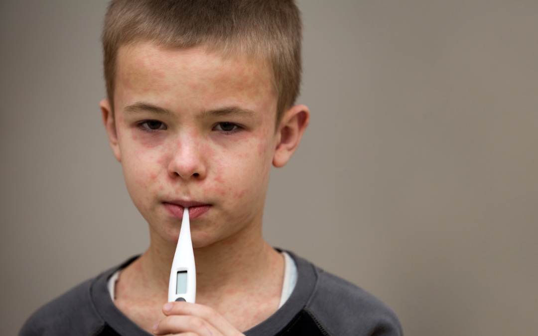 Should I Be Worried About the Measles Outbreak?